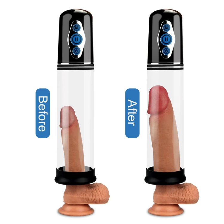 pompka Maximizer Worx Elite Rechargeable Pump