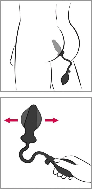 korek analny Anal Expert